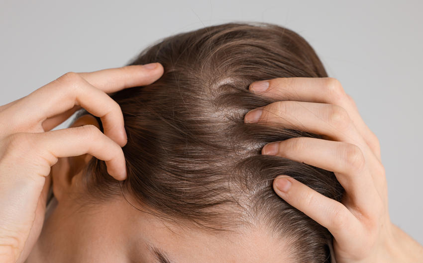 effective minoxidil treatment